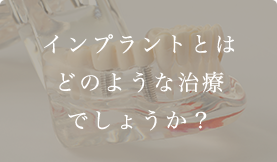 インプラントとはどのような治療でしょうか？