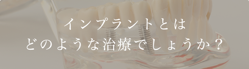 インプラントとはどのような治療でしょうか？