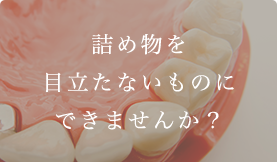 詰め物を目立たないものにできませんか？